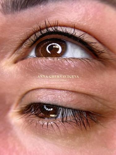 eyelash-enhancement.